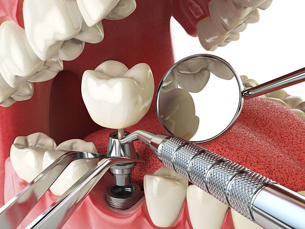 Best Walk-In Emergency Dentist in Green Valley, CA